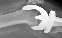 Farm Featured in Orthopedic Design & Technology Magazine &ndash; May/June 2011