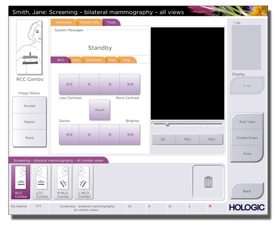 Hologic GUI-1