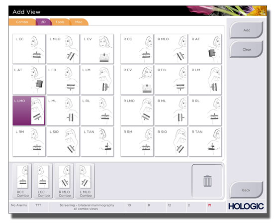 Hologic GUI-2